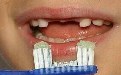 社会百态图片：专门为缺牙小朋友设计的牙刷